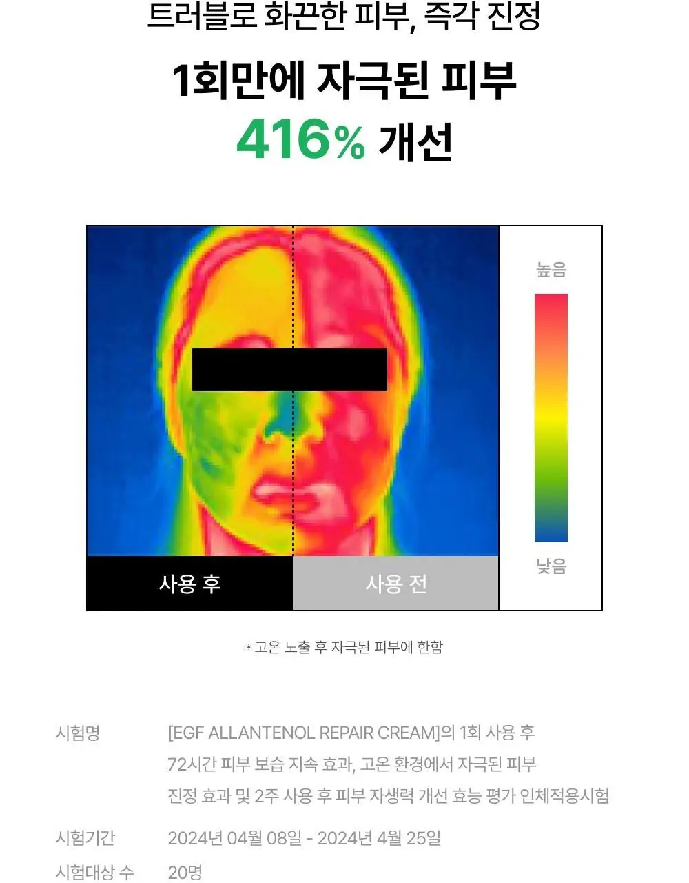 [수분/진정] 셀인샷 EGF 알란테놀 트러블 크림 70ml 상세페이지 12